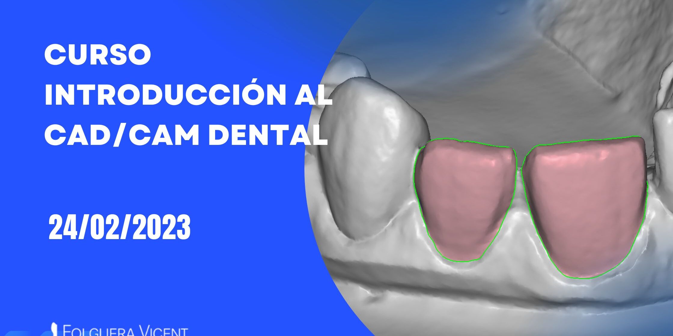 CURSO CAD-CAM INTENSIVO.